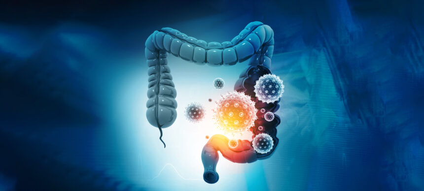  Long COVID and the Gut