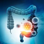  Long COVID and the Gut