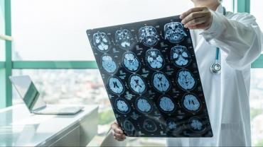 Brainstorm-Concussion Treatment Update