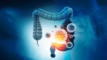  Long COVID and the Gut