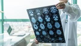 Brainstorm-Concussion Treatment Update