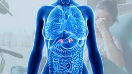 Adrenal Fatigue: Diagnosis & Treatment  